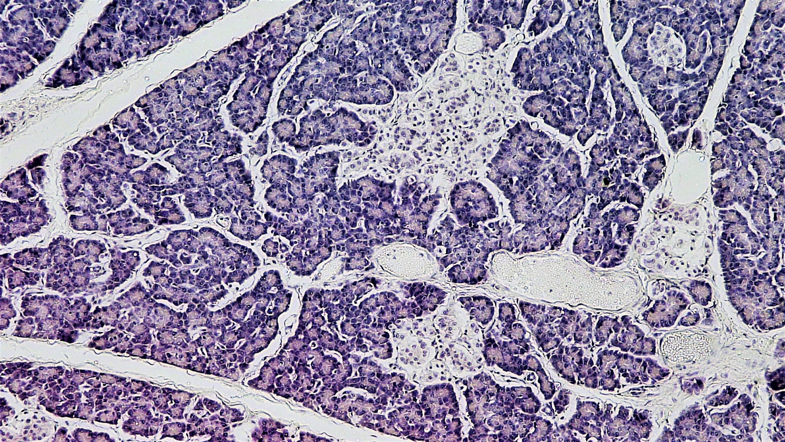 Microbiota intestinale e risposta alla terapia nel tumore del pancreas