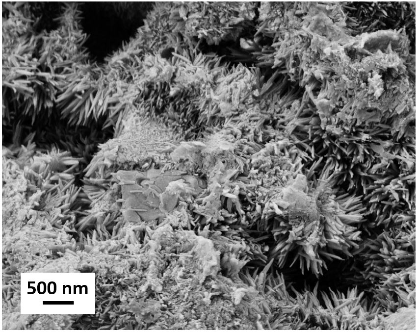 Dinamica 2.0, un progetto tra materiali biomimetici e farmaci mirati per le metastasi ossee