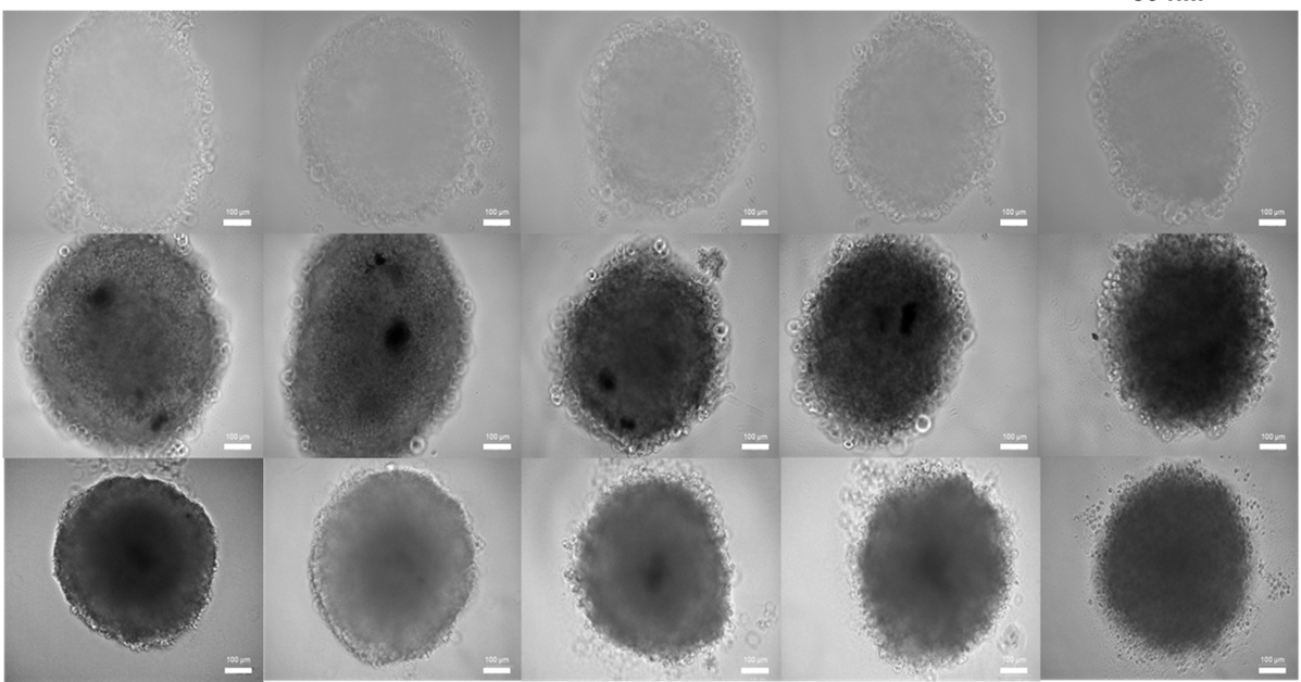 Glioblastoma, un modello in vitro per lo studio del trattamento