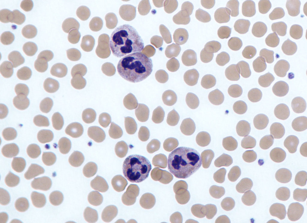 Neutrophils