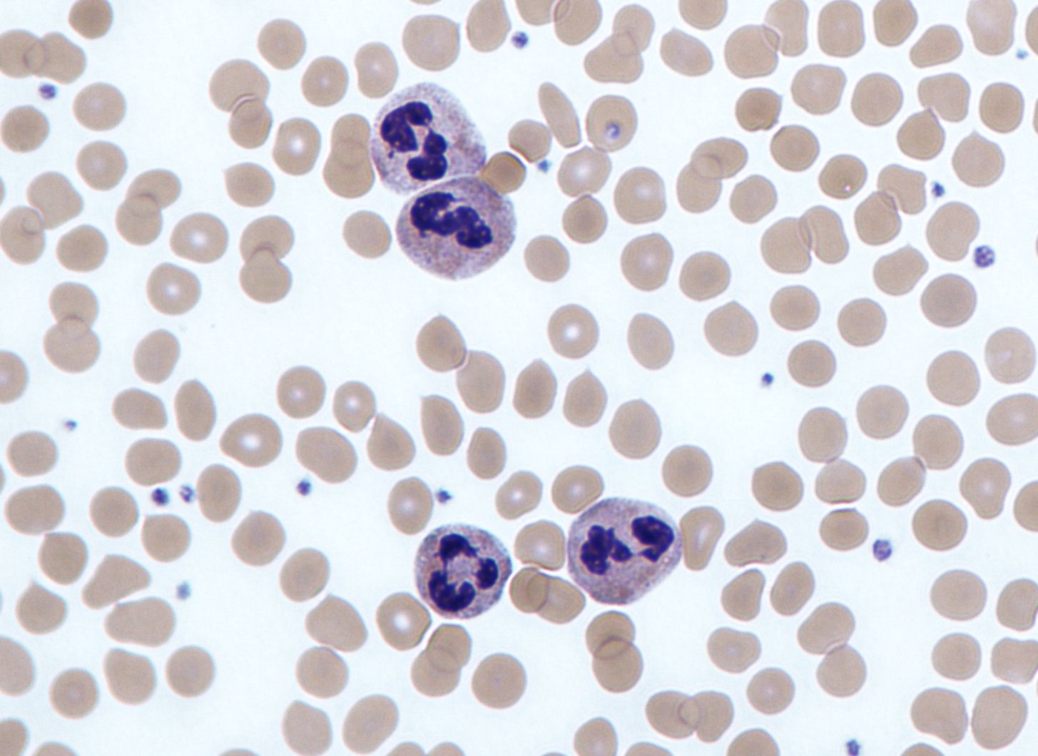 Alla scoperta dei progenitori più numerosi tra i globuli bianchi