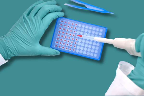 mani con guanti la laboratorio e piastra di coltura