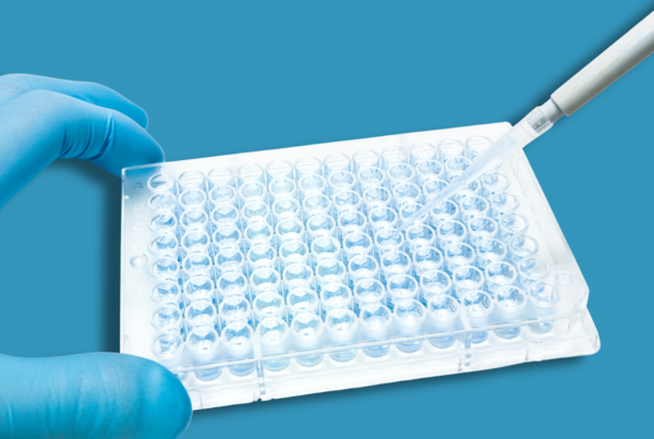 mani con piastra di cellule