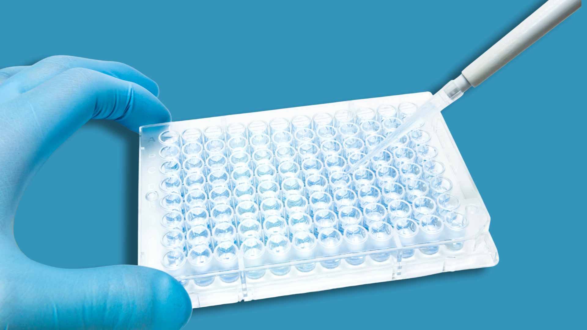 Dall’in silico all’in vivo: un esempio di ricerca farmacologica sulla sclerosi multipla